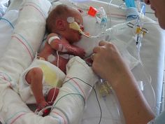 a baby is being hooked up to an oxygen tube