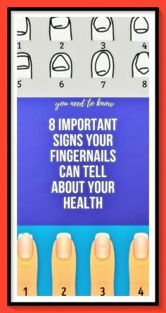 Sugar Symptoms, Body Attack, Tongue Scraper, Health Signs, Tongue Health, Brown Spots On Face, Baking Soda Shampoo, Striped Nails, Health Guide