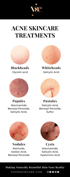 Healthy Skin Care Acne, Facial Exfoliant, Skin Facts, Skin Advice, Skin Care Routine Order, Skin Care Guide, Clear Healthy Skin