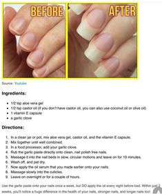 Strength Nails, Nail Growth Tips, Vitamin E Capsules, Make Up Foundation, Natural Nail Care, How To Grow Nails, Nail Growth, Growth Serum, Strong Nails