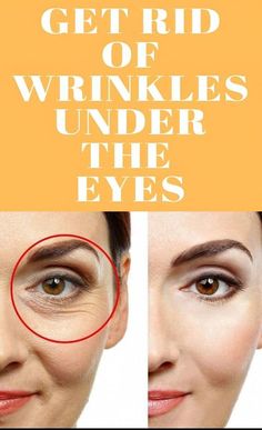 GET RID OF WRINKLES UNDER THE EYES
#wrinkle #wrinkleremover #wrinklesremediesface #wrinkles #wrinklesaroundmouth #wrinklearoundmouth #wrinkletreatment #howtogetridofrinkles #HOWTOREMOVEWRIKLE #wrinklecream #USA #UNITEDSTATES #UNITEDKINGDOM #CANADA Erase Wrinkles, Skincare Secrets