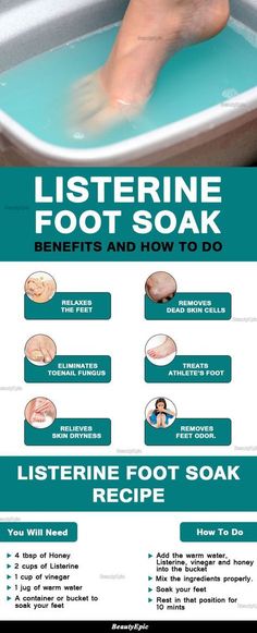 Listerine Foot Soak Benefits Listerine Foot Soak, Foot Soak Recipe, Makeup Tip, Foot Soak, Skin Dryness, Beauty Clinic, Diy Beauty Hacks, Health And Beauty Tips, Beauty Treatments