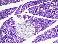 an animal's stomach showing the cross section and its tissue, with purple spots on it