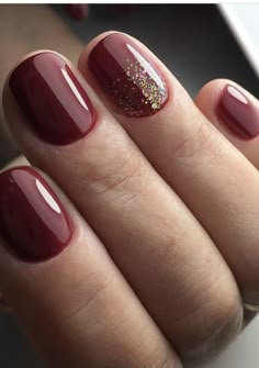 40s Nails, Gel Nails Ideas, Gel Colors, Med Tech, Christmas Gel Nails, Cute Gel Nails, Get Nails, Dipped Nails, Xmas Nails