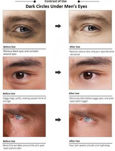 Saggy Eyes, How To Grow Eyebrows, Anti Aging Oils, Get Rid Of Blackheads, Makes You Beautiful, Best Anti Aging, Younger Looking Skin, Clean Face, Face Scrub