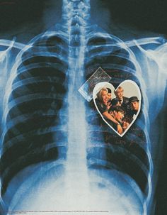 an x - ray image with two people and a heart