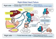 Jugular Venous Pressure, Central Venous Pressure, Physician Assistant School, Heart Fail, Chronic Lung Disease, Med Surg Nursing, Airway Management, Biomedical Science