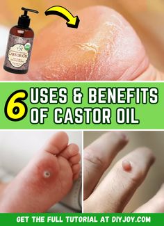 6 Surprising Uses & Benefits Of Castor Oil Castor Oil Skin, Castor Oil Benefits Skin, Castor Oil Pack Benefits, Benefits Of Castor Oil, Castrol Oil, Castor Oil For Skin, Castor Oil Packs