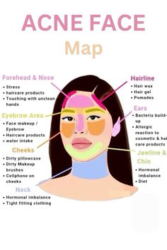 Acne Face Map, Face Map, Face Mapping Acne, Haut Routine, Forehead Acne, Face Mapping, Skin Advice, Acne Face, Natural Acne Remedies