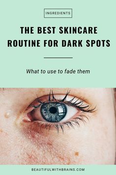 Skincare Routine For Dark Spots, Skincare Mistakes, Best Skincare Routine, Organic Skin Care Recipes, Lotion For Oily Skin, Oily Skin Acne, Skin Care Routine For 20s, The Best Skincare, Skincare Regimen