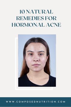 Learn which natural remedies are best for reducing hormonal acne! This post will give you an understanding of what hormonal acne is, the causes, and natural remedies to help alleviate it, whether you get PMS acne or cystic PCOS acne! Find more hormonal acne tips and natural hormone remedies at composednutrition.com. Foods That Contain Zinc, Acne Tips, Natural Hormones