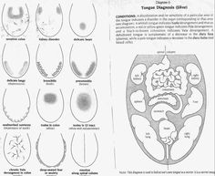 what you can learn from your tongue Acupuncture School, Body Points, Vata Diet, Herbal Knowledge, Herbal Health, Tongue Health, Health Heal, Medical Anatomy, Holistic Remedies