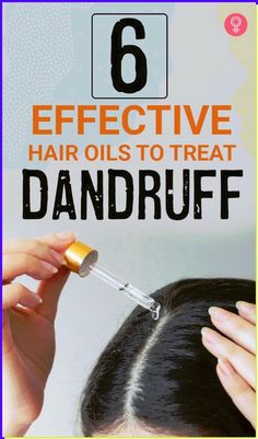 Dandruff Products, Severe Dandruff, Treat Dandruff, Prevent Dandruff, How To Treat Dandruff, Oils For Dandruff, Dandruff Hair, Dry Scalp Treatment, Dandruff Remedy