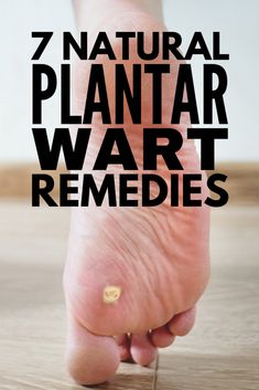 Plantar Wart Remedies, Home Remedies For Congestion, Plantar Warts, Home Remedy For Cough