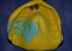 Dental impression Bright Smile, Humor, Humour