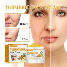 Turmeric Firming Skin Cream Wrinkle Reducing Cream 50g Dry Skin Tightening Women's Line Wrinkle Firming And Antis Aging Cream Features: Yellow Firming Skin : This is a perfect moisturizing firming skin for the face. It provides women with powerful -aging, wrinkle reduction, face lift and firming. -Wrinkle for Women's Face: This is an -wrinkle lotion for women that visibly relieves rough skin, provides a nice smoothing effect, reduces wrinkles, reduces signs of aging, and helps you have a truly s Dark Spot Corrector Serum, Organic Face Cream, Dark Spot Corrector, Serum Cream, Face Wrinkles, Soften Skin, Anti Aging Serum, Anti Aging Cream, Skin Cream