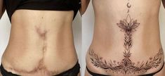 before and after photos of a woman's lower back tattoo