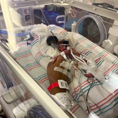 a person laying in a hospital bed with an iv attached to their arm and head