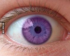 This is the Alexandria's Syndrome of the violet eyes! Lilac Eye, Gorgeous Eyes