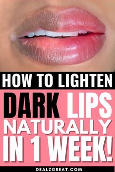 Lip Hyperpigmentation, Darkness Around Mouth, Pigmentation Remedy, Remedies For Dark Lips, Lighten Dark Lips, Lip Lightening, Nail Problems, Pigmented Lips, Organic Remedy