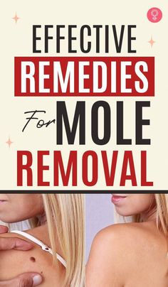 Annoyed by that ugly mole on your face? We know how you loathe the appearance of that mole. Here are effective home remedies for mole removal to help you out How To Remove A Mole On Face, Mole Remover Diy, How To Get Rid Of Moles On Your Face, Remove Moles At Home, Get Rid Of Moles On Skin, Essential Oils For Moles Removal, Removing Moles Naturally, Mole Removal Before And After, How To Get Rid Of A Mole