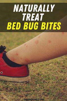 a woman's legs with red shoes and the words naturally treat bed bug bites