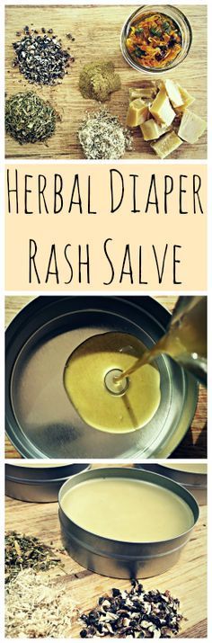 A recipe for a homemade, DIY herbal diaper rash salve that works! Diy Body Care, Herbal Healing, Homemade Diy, Herbs For Health, Homemade Remedies