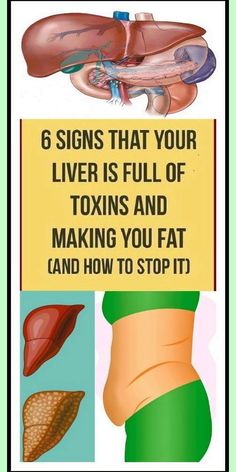 Astounding  info! The Liver, Stop It, Detox Smoothie, Oral Health, Health Remedies, Way Of Life