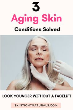 3 Aging Skin Conditions Solved - Now You Can Look Younger Without A Facelift Look Younger, Skin Conditions, Aging Skin, Conditioner, Skin