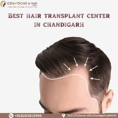 If you are seeking the Best Hair Transplant Center In Chandigarh, look no further than Chandigarh Hair Transplant. In this blog, we'll explore what makes Chandigarh Hair Transplant the premier destination for hair restoration in the region.