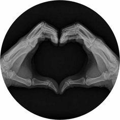 an x - ray image of two hands in the shape of a heart