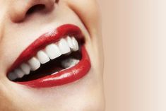 Zoom Teeth Whitening, Dental Posters, Invisible Braces, Laser Teeth Whitening, Porcelain Veneers