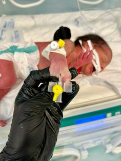 a person in black gloves holding an oxygen tube to a baby's head and nose