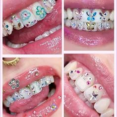 four pictures of different types of teeth with various designs on them, all in white and pink