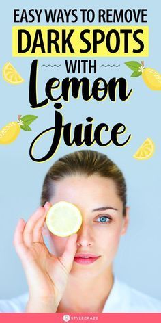 How To Use Lemon To Lighten Skin, Dark Spot Remover For Face Homemade, How To Treat Dark Spots On Face, How To Remove Spots On Face, How To Remove Sun Spots On Face, Remove Sun Spots On Face, Natural Dark Spot Remover For Face, Herbs For Dark Spots