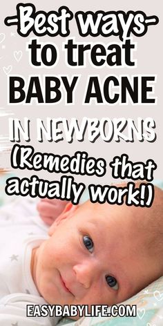 a baby laying on its back with the words best ways to treat baby acne in newborn