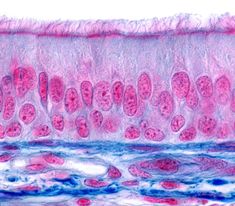 an image of some pink and blue cells