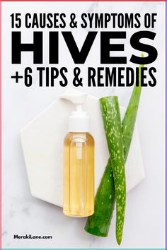 How to Get Rid of Hives | Whether your hives (or urticaria) are chronic or acute, caused by a histamine intolerance, an allergic reaction, or stress, finding relief for this itchy and irritating rash is important. In this post, we share everything you need to know - the signs and symptoms of hives, common causes, and natural remedies for fast relief. From at-home treatments like oatmeal and baking soda baths, witch hazel, cold compresses, and more, these home remedies work! How To Treat Hives, Natural Remedies For Hives, Witch Hazel Benefits, Home Remedies For Hives, Home Remedies For Rashes, Hives Remedies, Age Spot Remedies, Chronic Hives, Soothing Face Mask