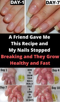 A Friend Gave Me This Recipe and My Nails Stopped Breaking and They Grow Healthy and Fast #nail #skin #beauty #beautytips #beautyrecipes Make Nails Grow, Grow Long Nails, Health Signs, Tongue Health, Nagel Tips