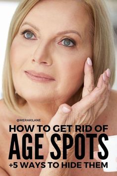 Age Spot Remedies, Age Spots On Face, Anti Aging Skincare Routine, Best Lotion, Spots On Face, Prevent Aging, Makeup Hacks, Deep Skin, Health Skin Care