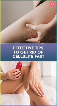 Effective Tips To Get Rid Of Cellulite Fast Cold Sore Relief, Girl Hacks, Health Guru, Dark Underarms, Under The Skin, Feminine Health, The Dating Divas, Home Beauty Tips, Cold Home Remedies