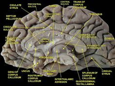 an image of the human brain labeled in all its major parts and functions, including cerebratorys