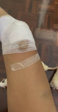 a woman's leg with bandages on it and a dog laying next to her