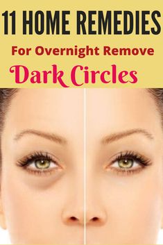 Overnight Beauty Tips, Getting Rid Of Dandruff, Natural Beauty Remedies, Overnight Beauty, Spots On Face