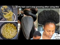 Natural Hair Oils For Black Hair, Regrow Hairline, Hair Growth Serum Diy, 4c Hair Growth, Wrinkles Remedies, Grow Black Hair, Regrow Hair Naturally