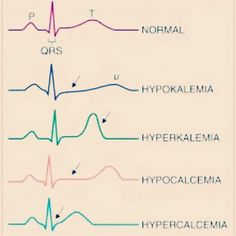 Nurses Life, Pass Nursing School, Nursing Study Tips, Np School, Emergency Nurse