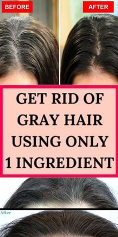 Grey Hair Home Remedies, Grey Hair Remedies, Homemade Medicine, Grey Hair Care, Hair Remedies, Gray Hair, Grey Hair, White Hair, Only 1