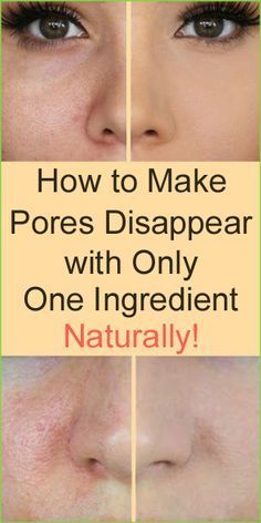 Natural Face Skin Care, Face Wrinkles, Skin Remedies, Skin Care Remedies, Beauty Skin Care Routine, Face Skin Care