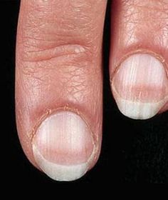 Fingernail Health, Pale Nails, Shape Magazine, Glow Skin, Nail Health, Health Info, Health And Beauty Tips, Diet Plans, Health Remedies