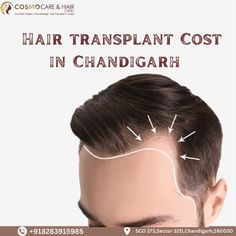 In this blog, we'll break down the elements that determine Hair Transplant Costs In Chandigarh, helping you make an informed decision about your hair restoration journey.